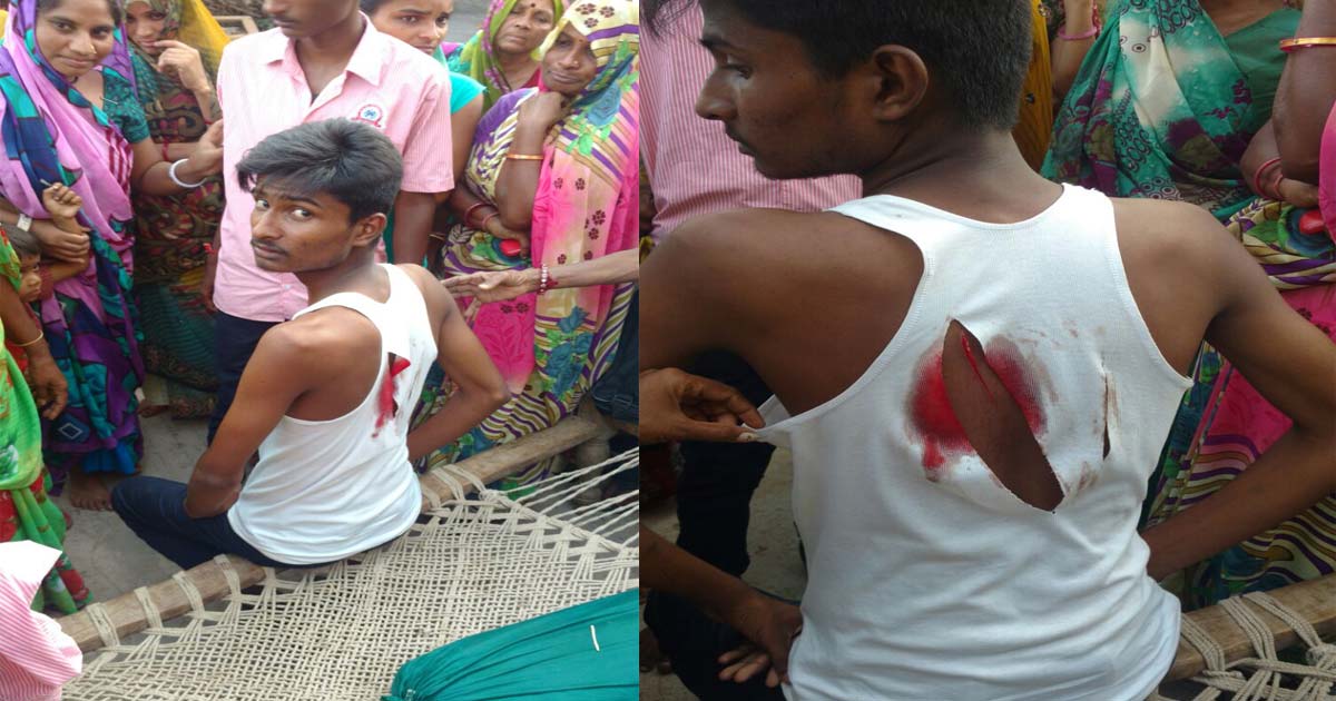 http://www.meranews.com/backend/main_imgs/dalitoflibodara_gandhinagar-bikers-attack-on-dalit-boy_0.jpg?39